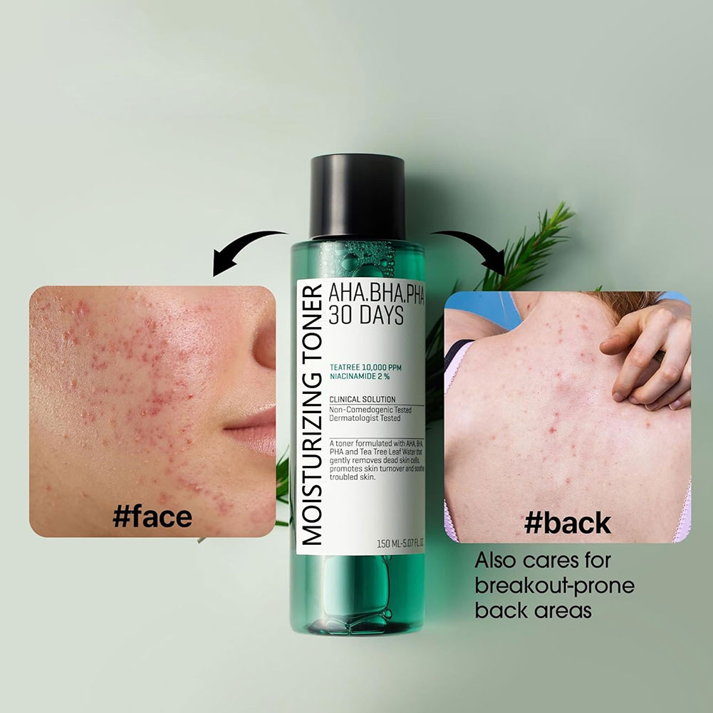 Some by Mi Aha.Bha.Pha 30 Days - Skincare Some By Mi review and price