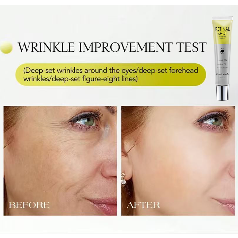 Retinal 0.1% Intensive Shot Pa - Retinol Vitamin A Cream review and price
